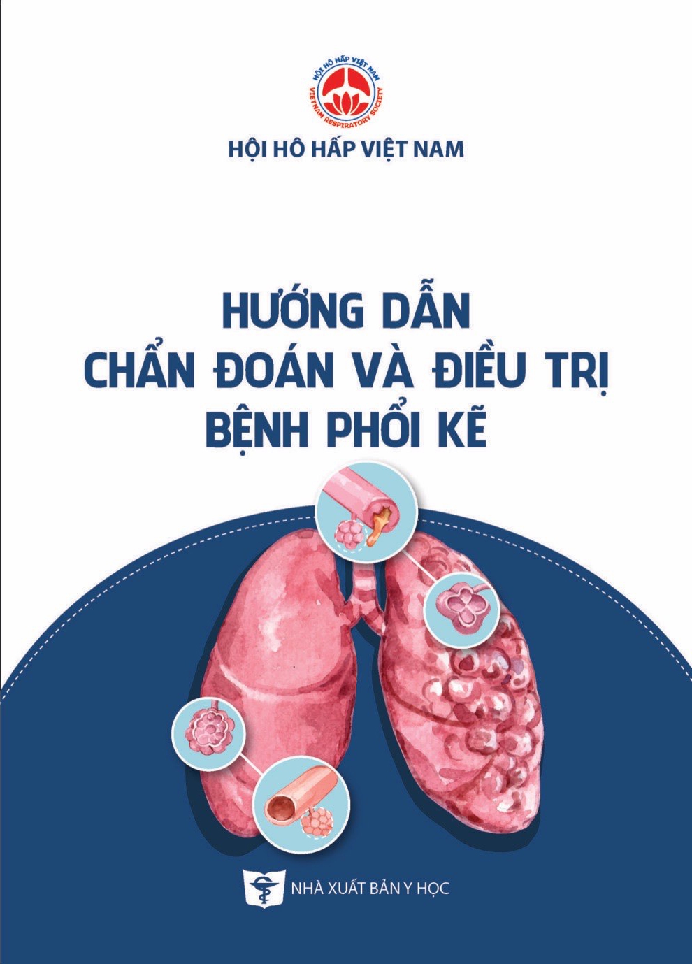 Hướng dẫn chẩn đoán và điều trị bệnh phổi kẽ