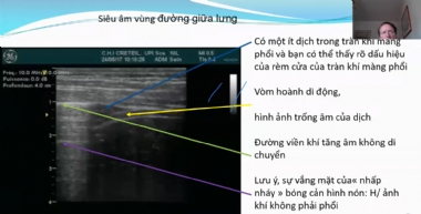 Bệnh lý màng phổi: Ca lâm sàng