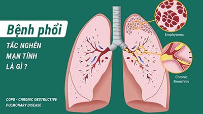 Thăm dò chức năng thông khí